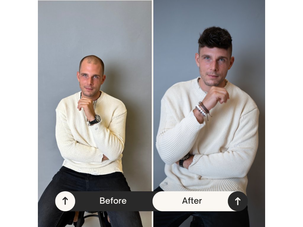 Beige Minimalist Skincare Before and After Instagram Post (1)